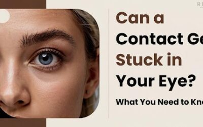Can a Contact Get Stuck or Lost in Your Eye? How to Remove It Safely